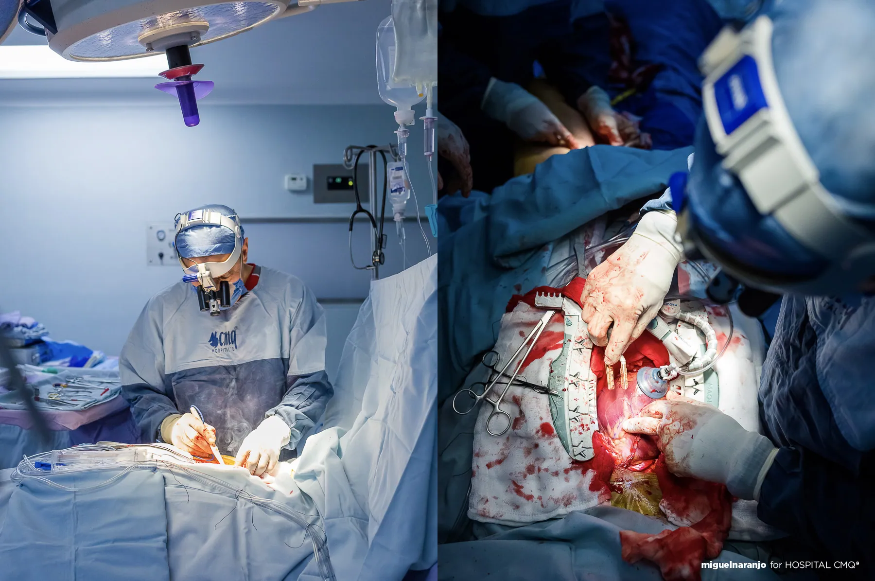 Cirugía de corazón abierto en Hospital CMQ Premiere, Puerto Vallarta